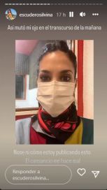 Silvina Escudero contó un problema de salud que atraviesa y preocupó a sus seguidores
