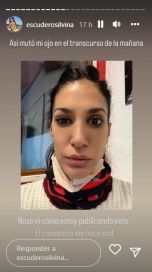 Silvina Escudero contó un problema de salud que atraviesa y preocupó a sus seguidores